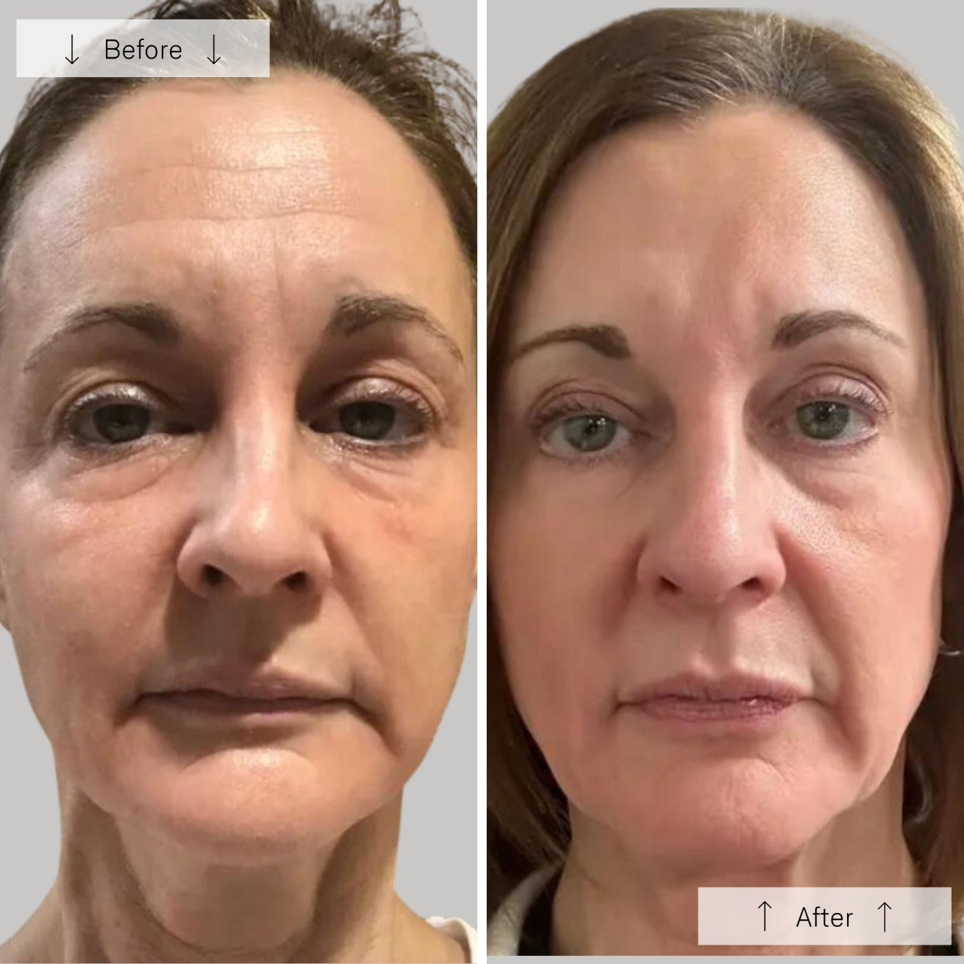 NYC Anti-Aging™