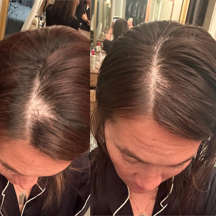 G'Hair ™ Growth Serum