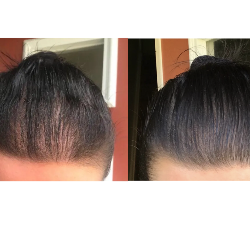 G'Hair ™ Growth Serum