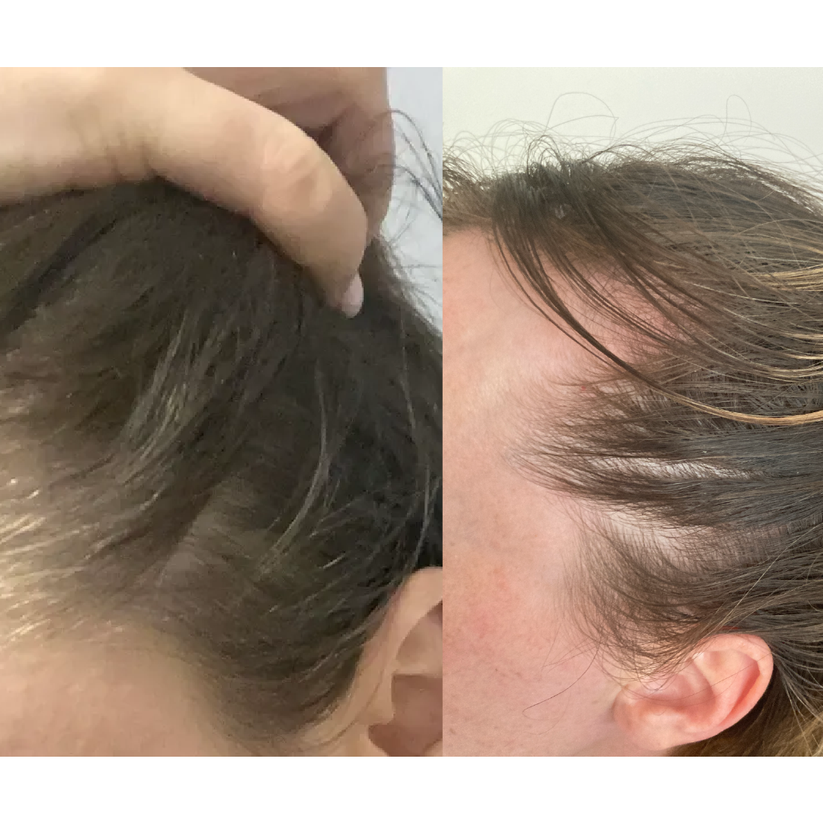G'Hair ™ Growth Serum